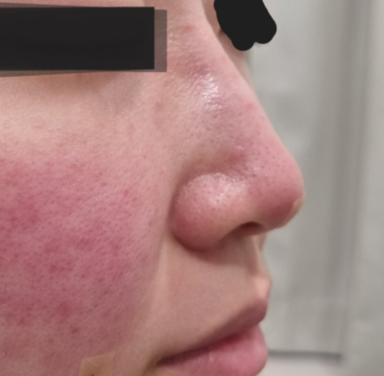 ウィジュンブフィラー