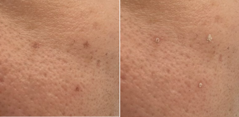 Clarity Toning