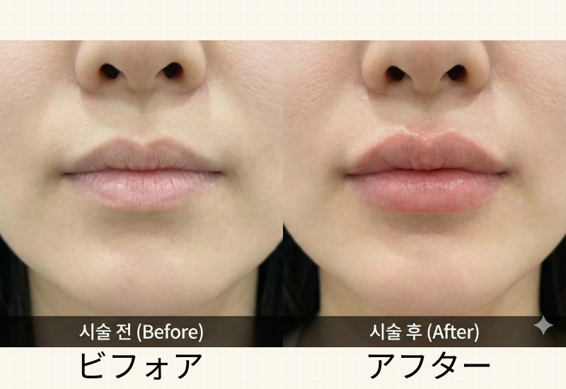 誰が施術するか