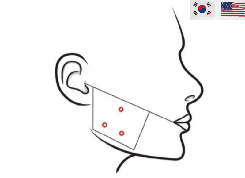Square Jaw Botox