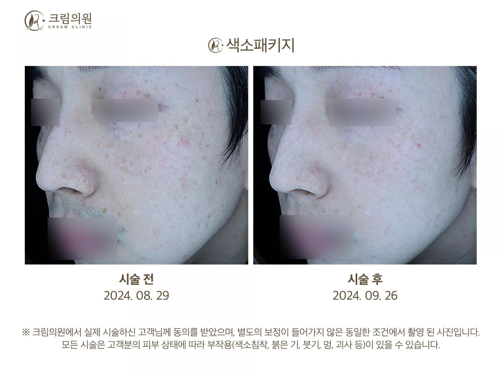 색소패키지 이미지