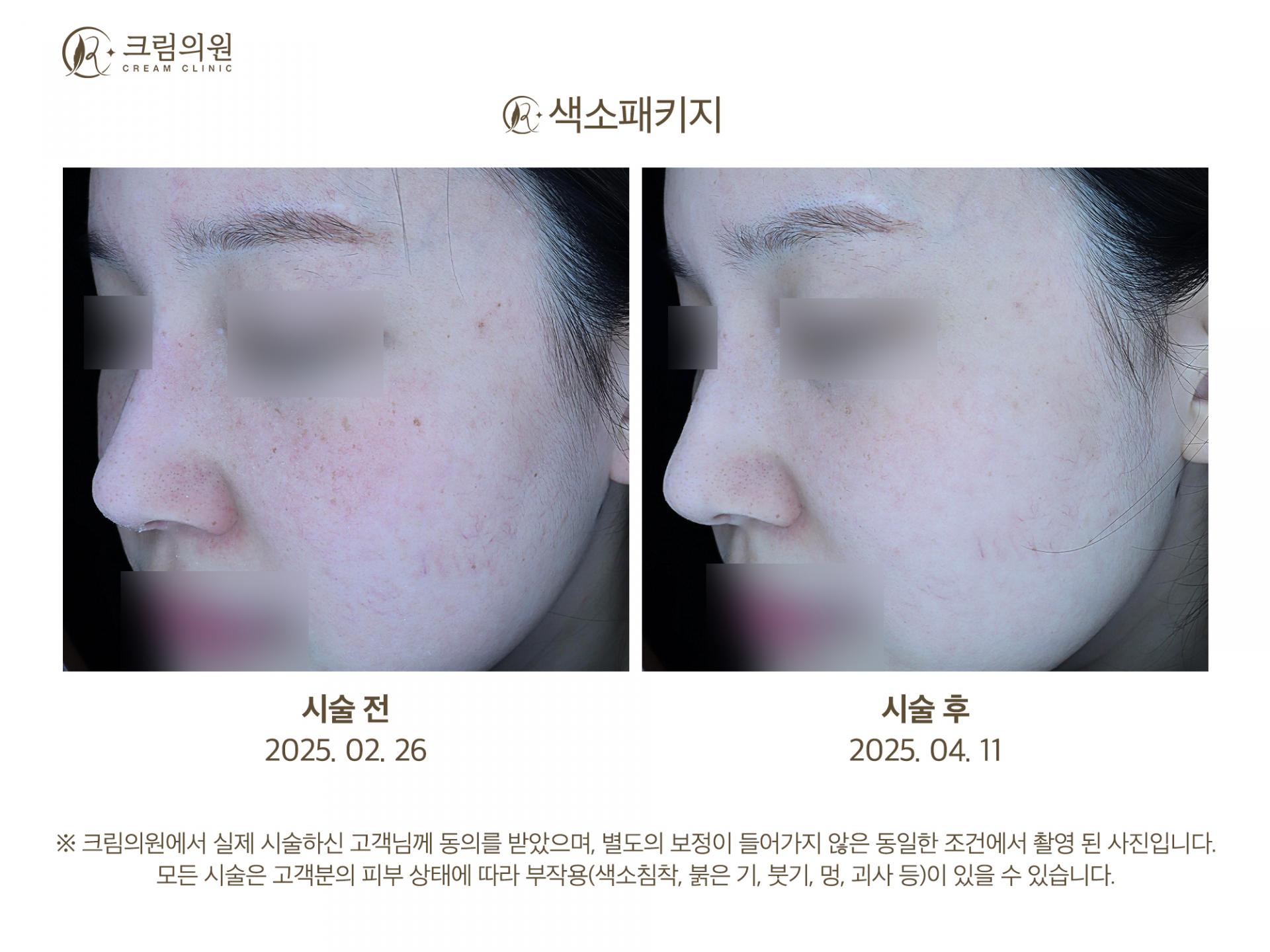 색소패키지 이미지