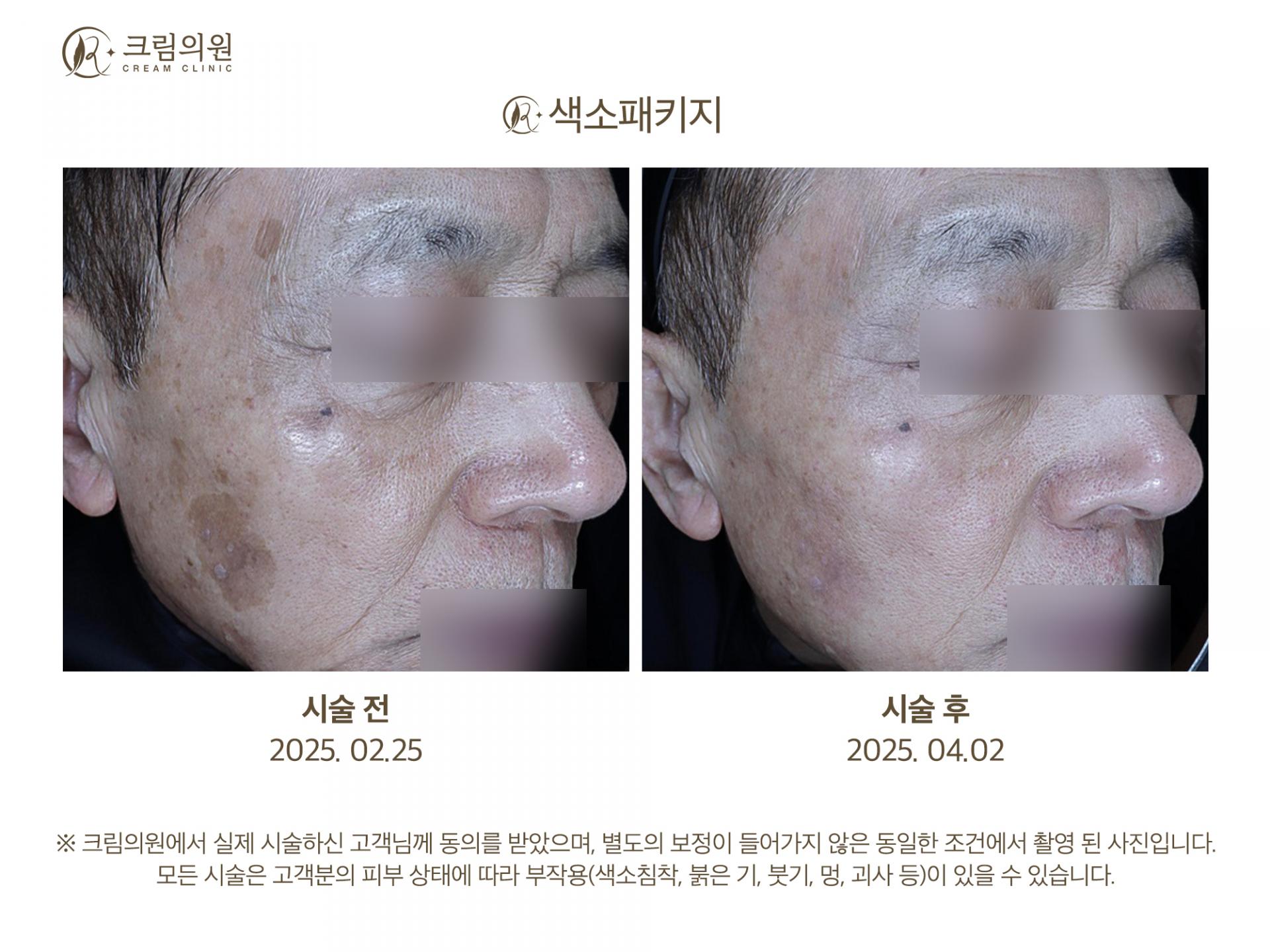 색소패키지 이미지