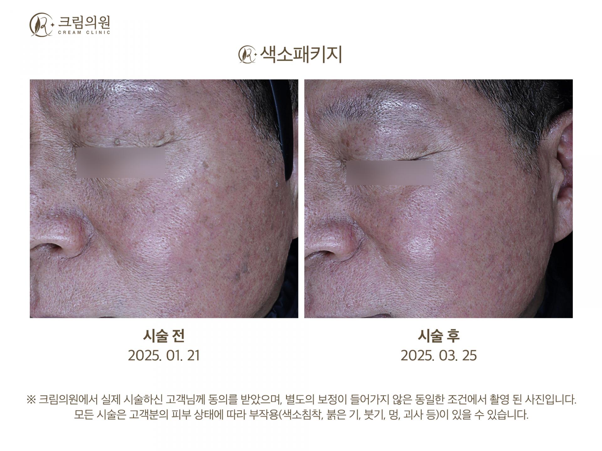 색소패키지 이미지
