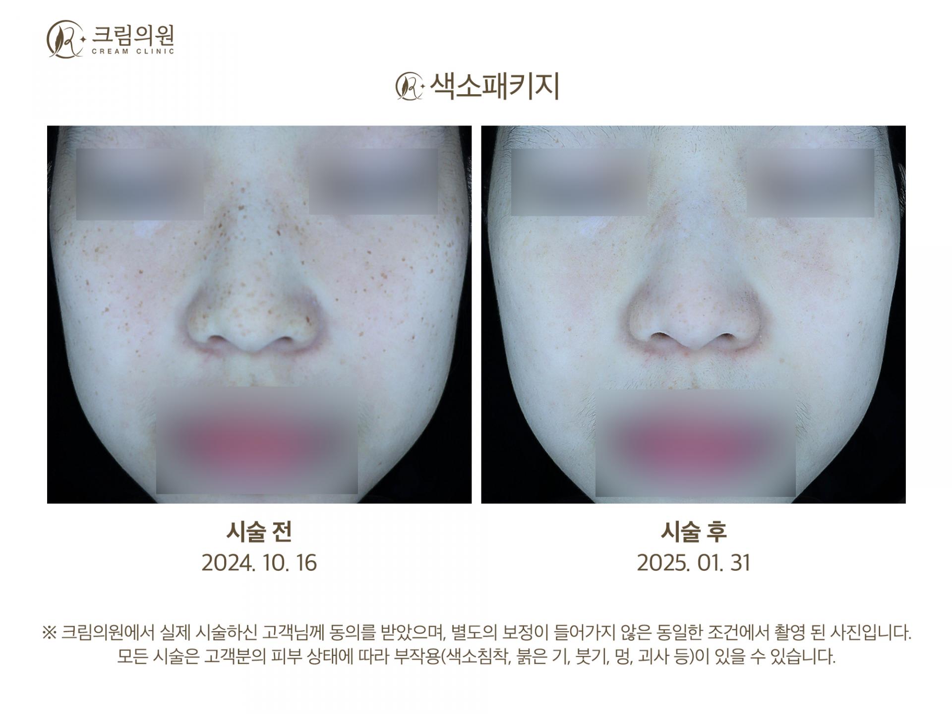 색소패키지 이미지