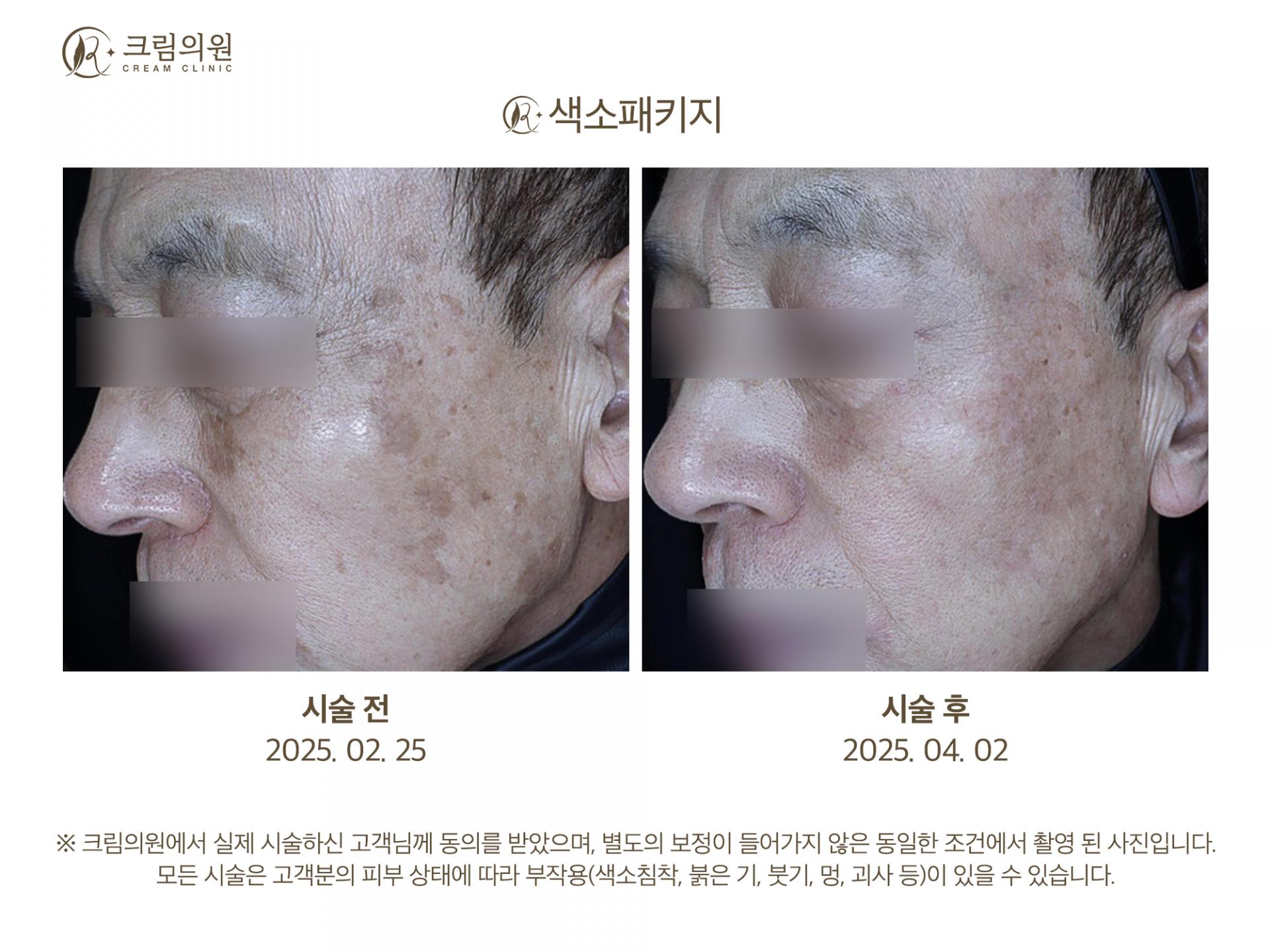 색소패키지 이미지