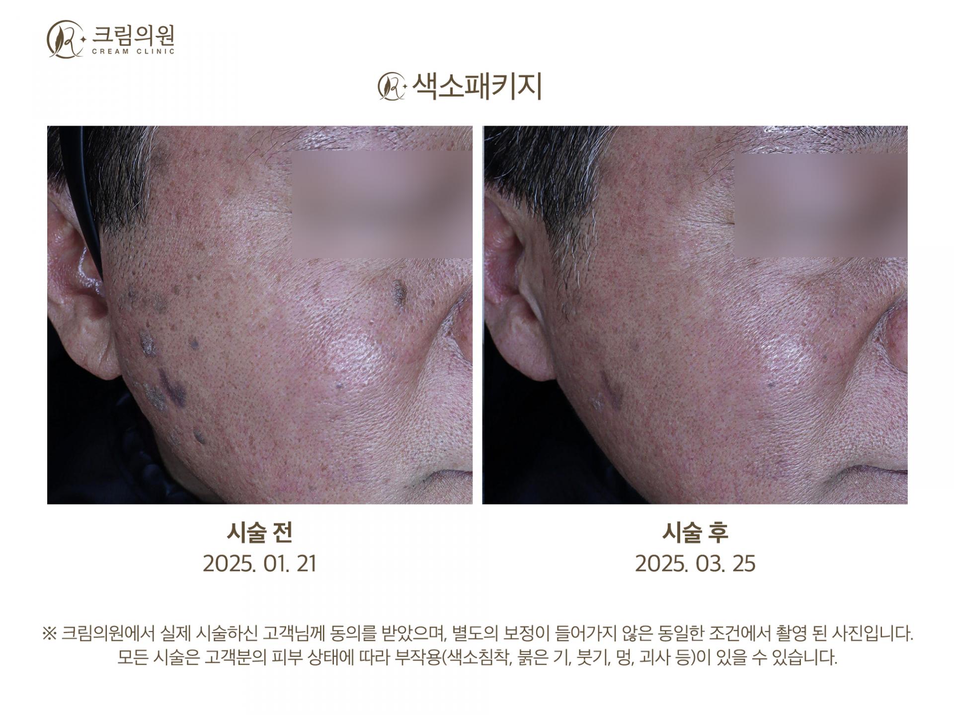 색소패키지 이미지