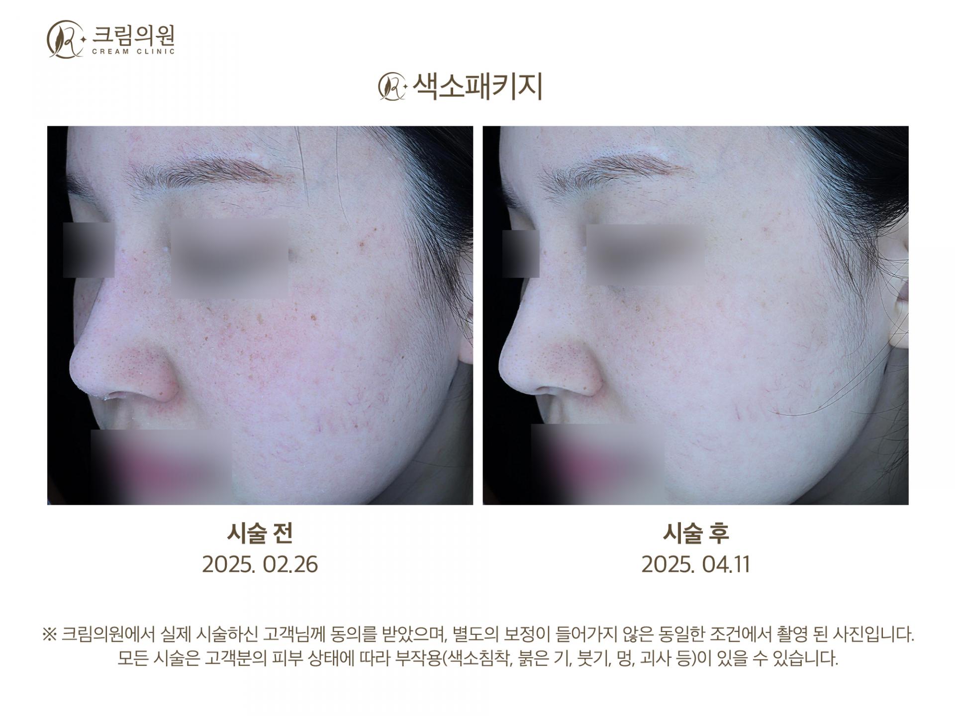 색소패키지 이미지