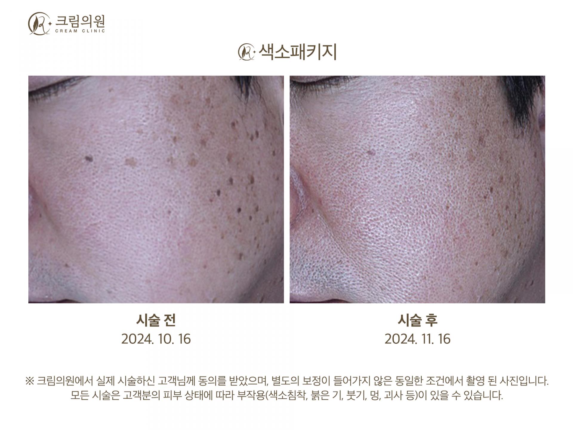 색소패키지 이미지