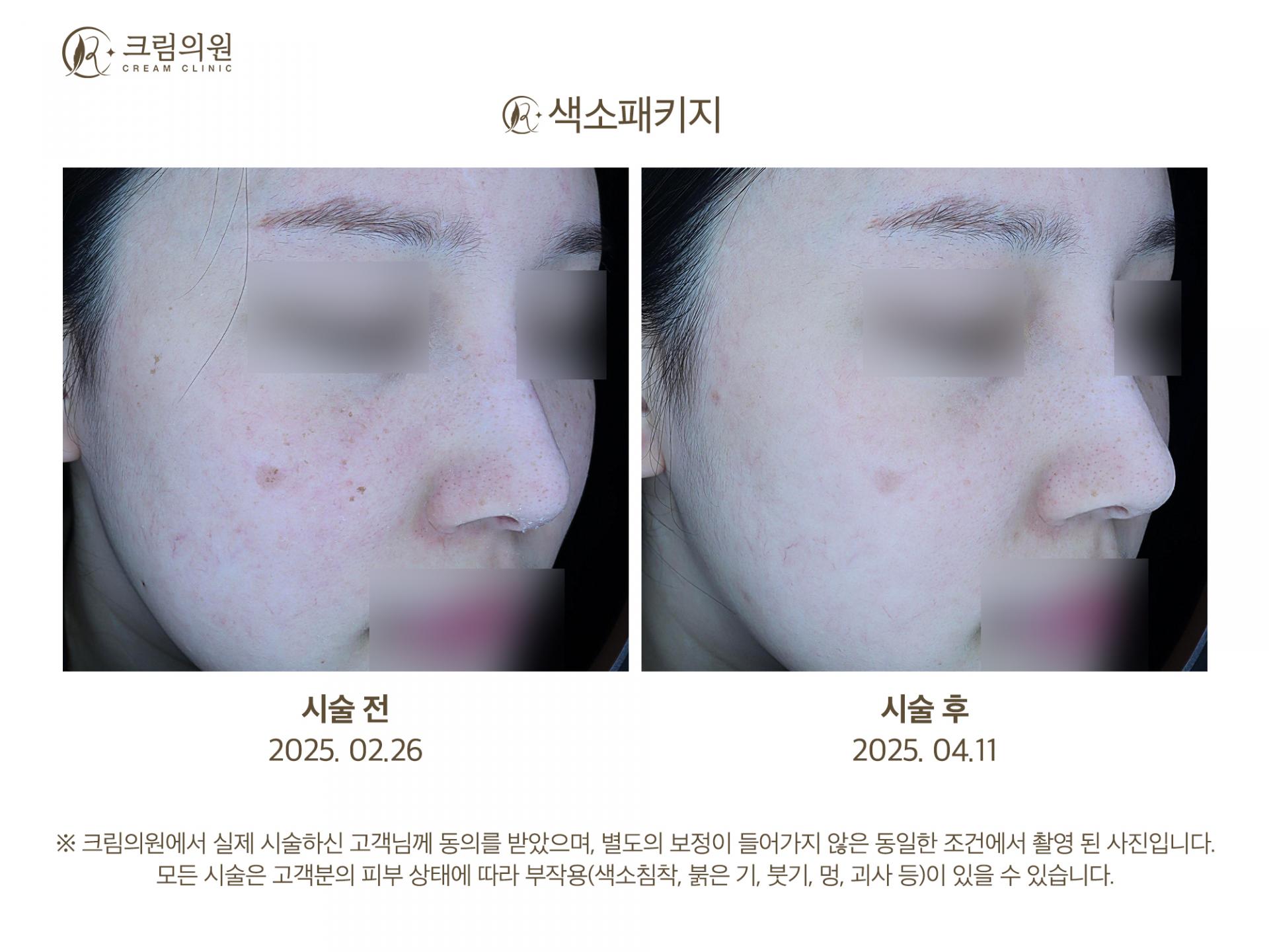 색소패키지 이미지
