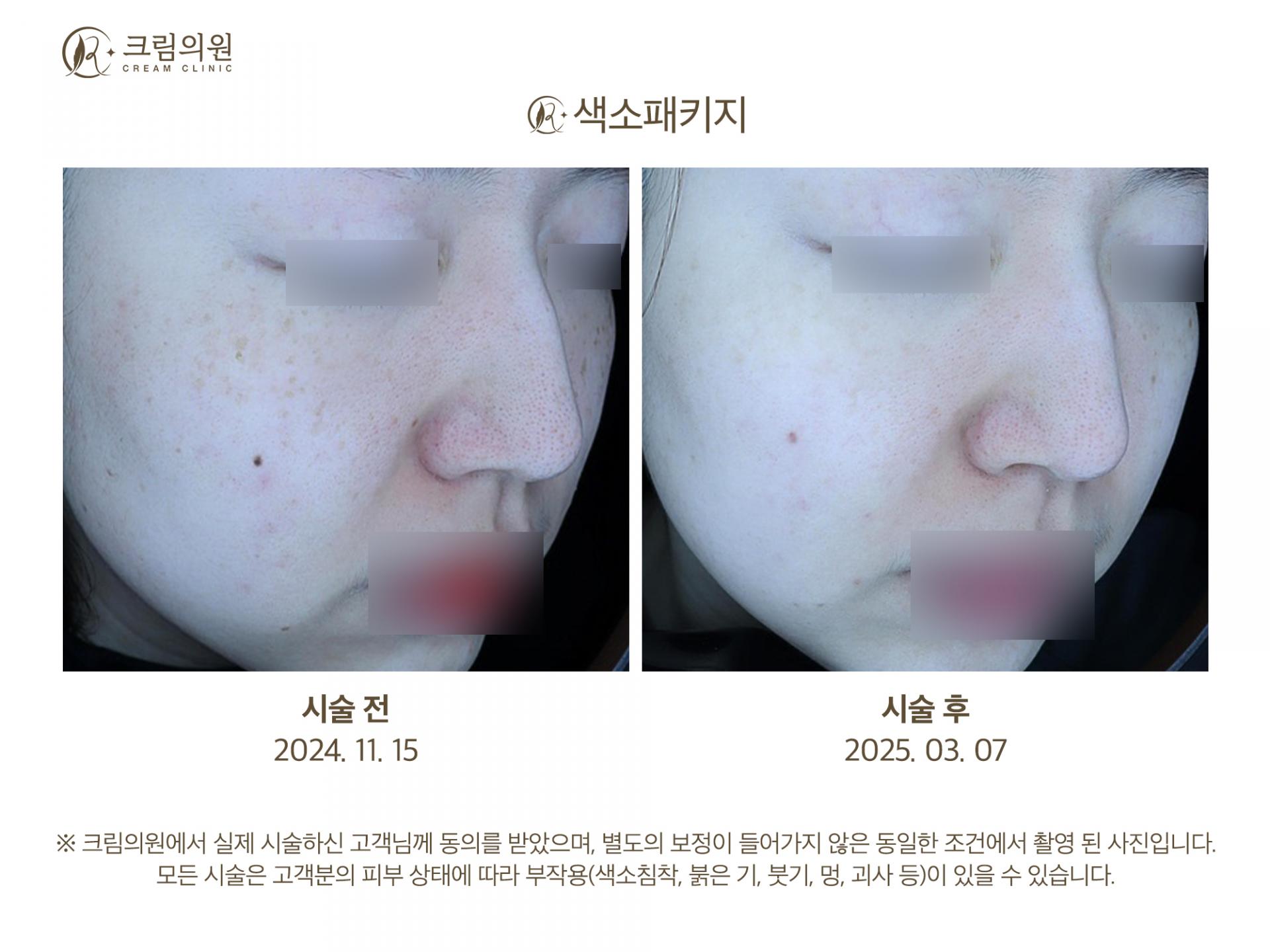 색소패키지 이미지