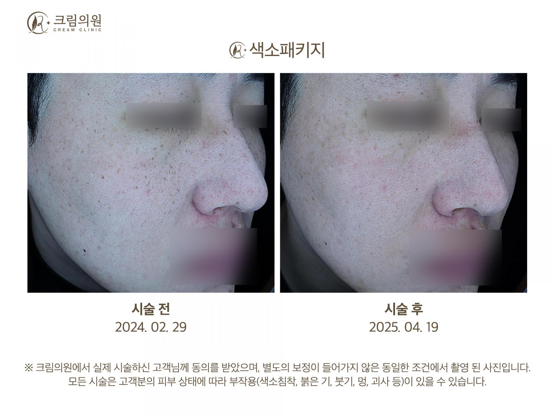 색소패키지 이미지