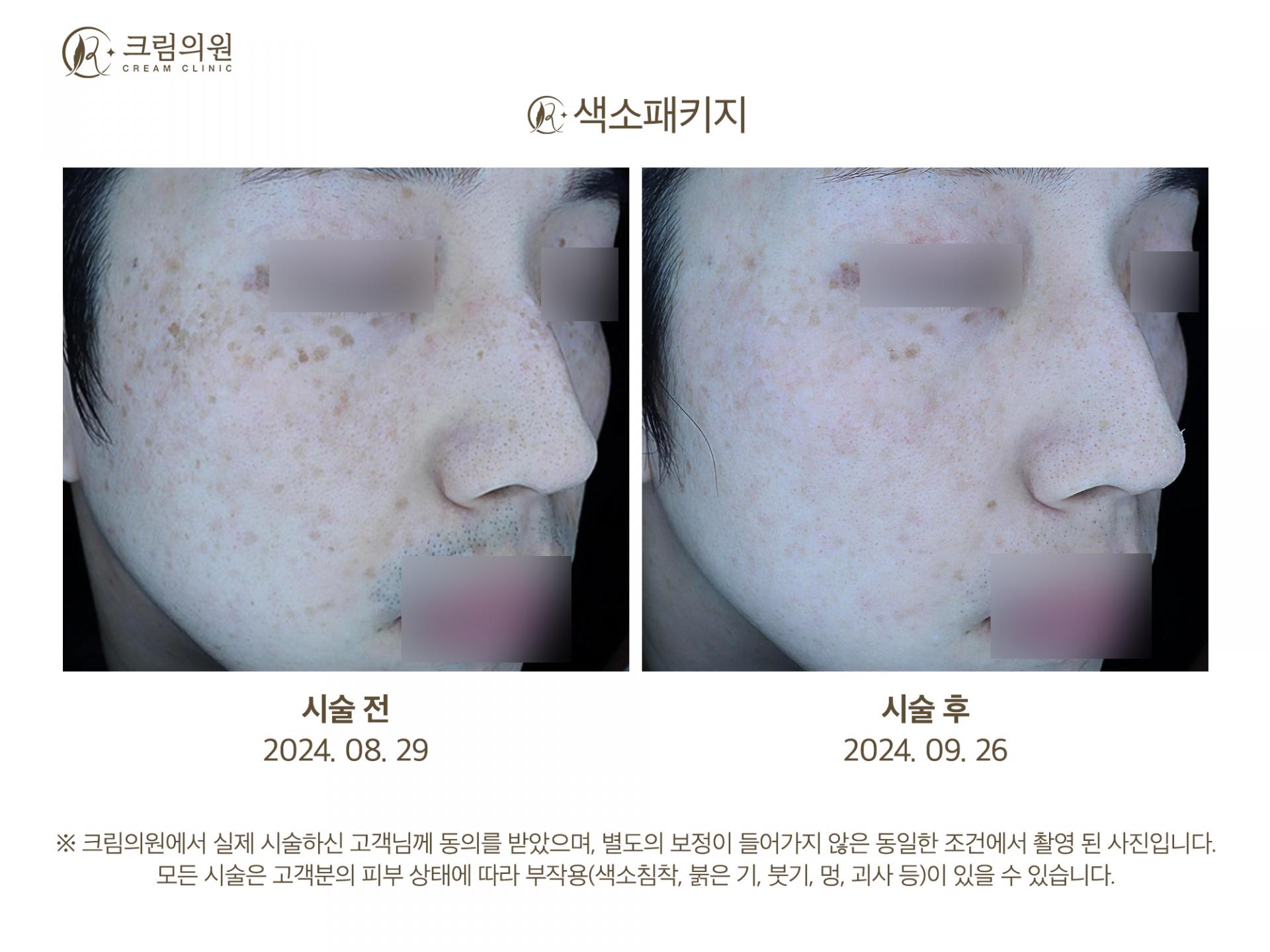 색소패키지 이미지
