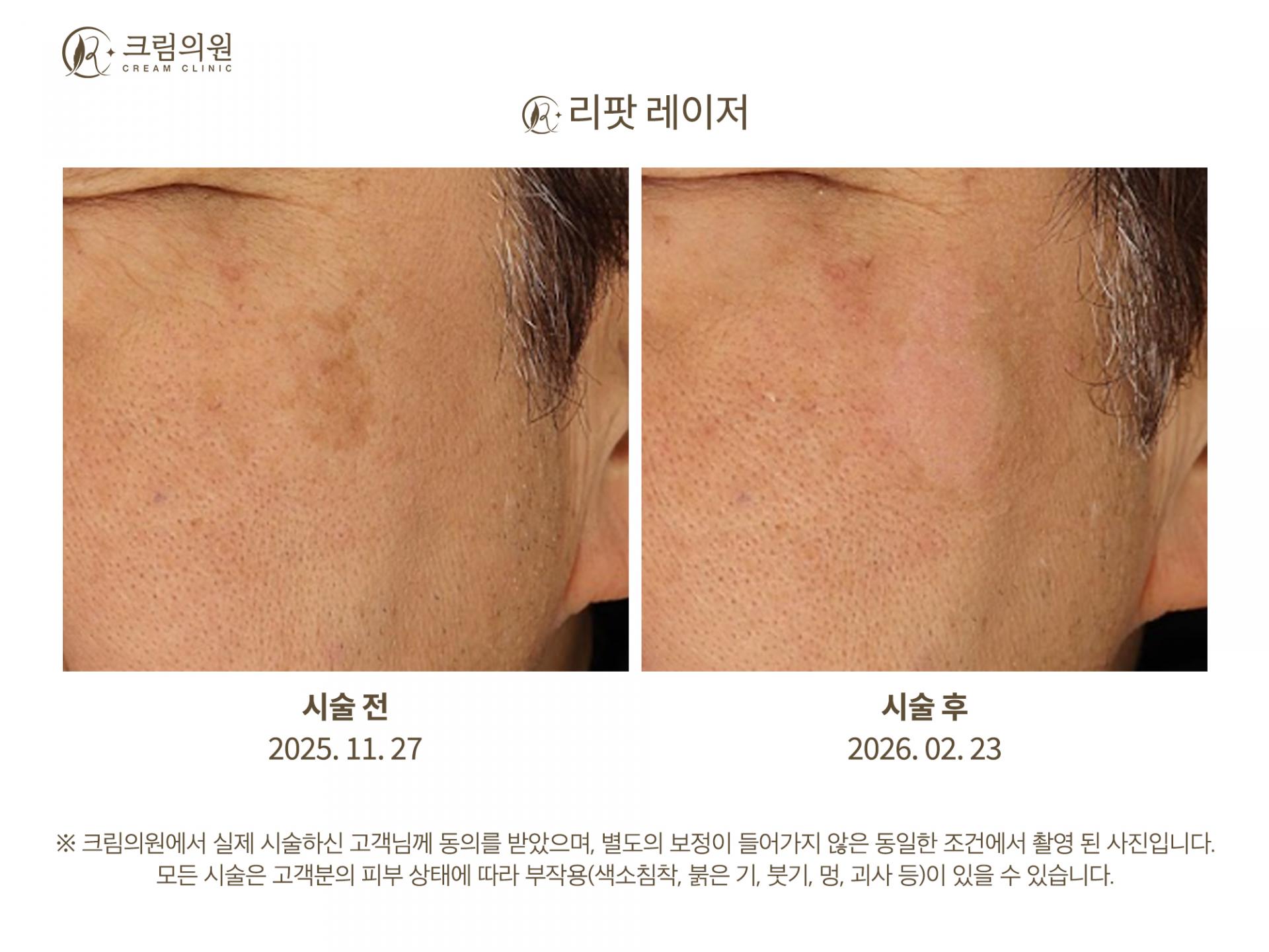 색소패키지 이미지