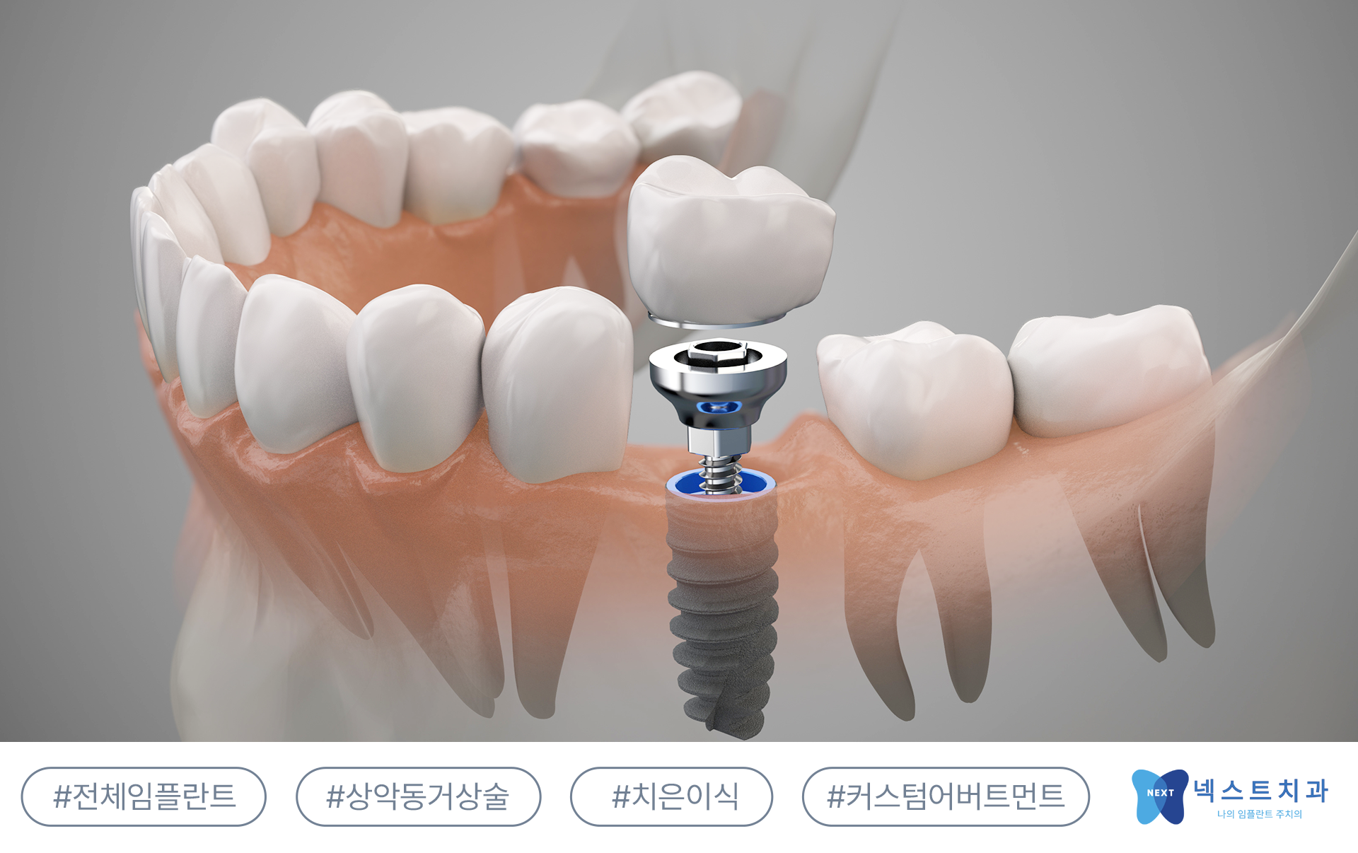 진료 이미지