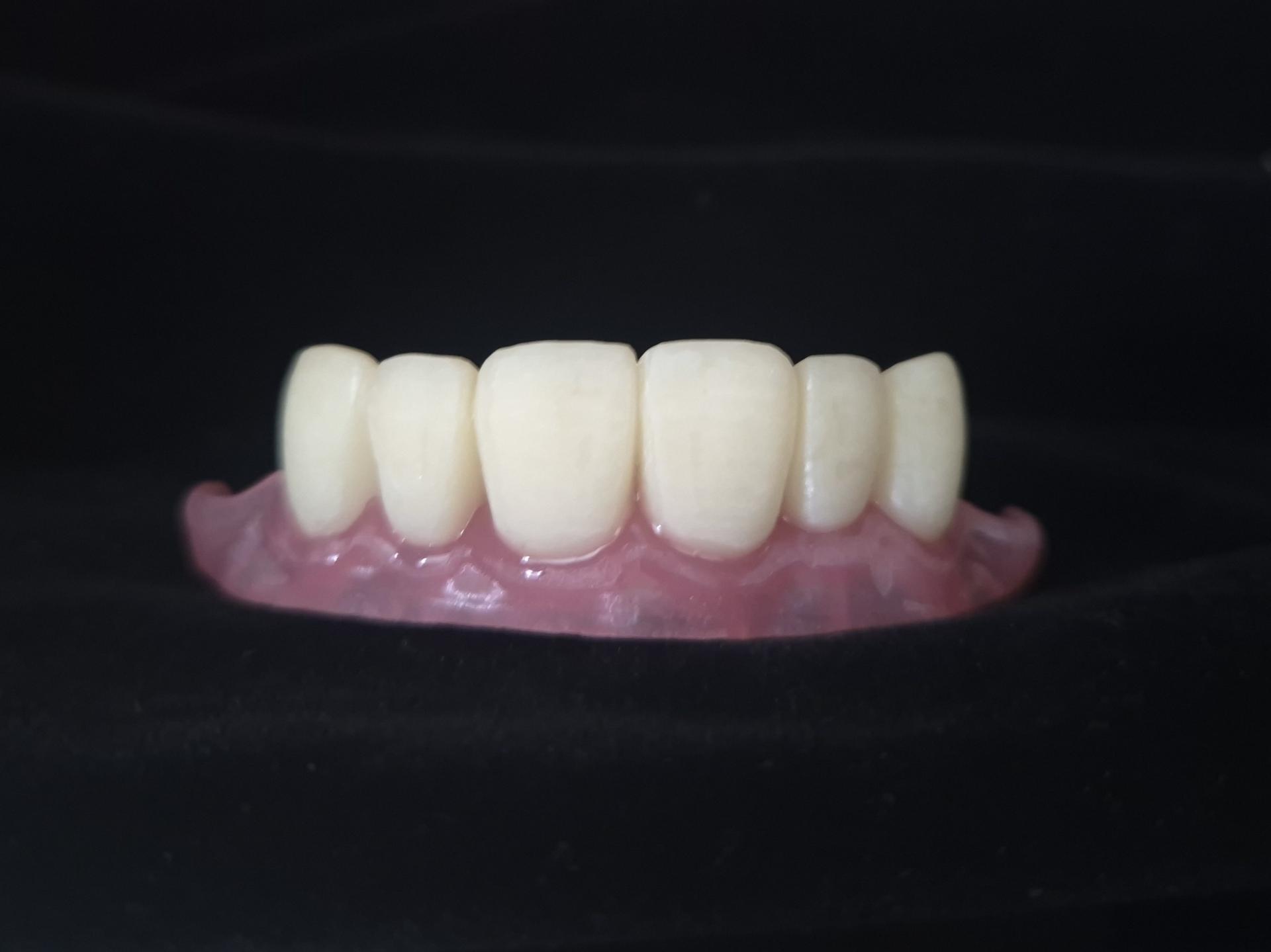 5aa3531590584.jpg