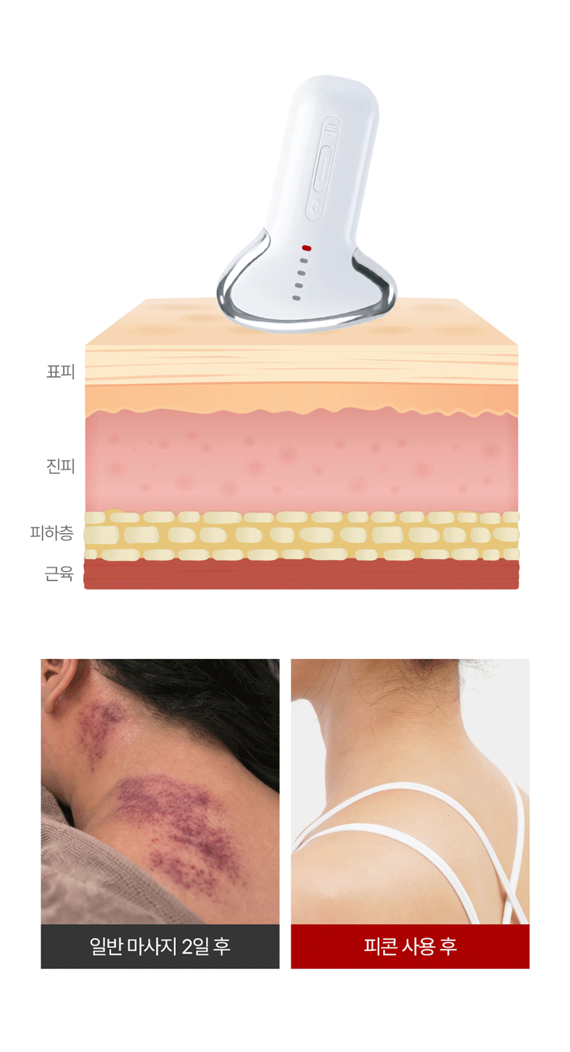 PICON 3rd Generation Fascia Massager V2