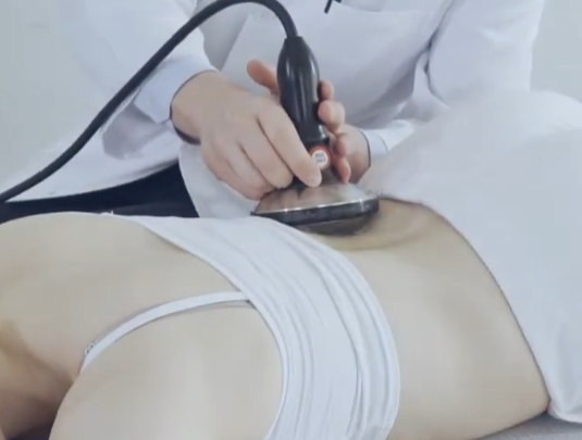 체외충격파치료