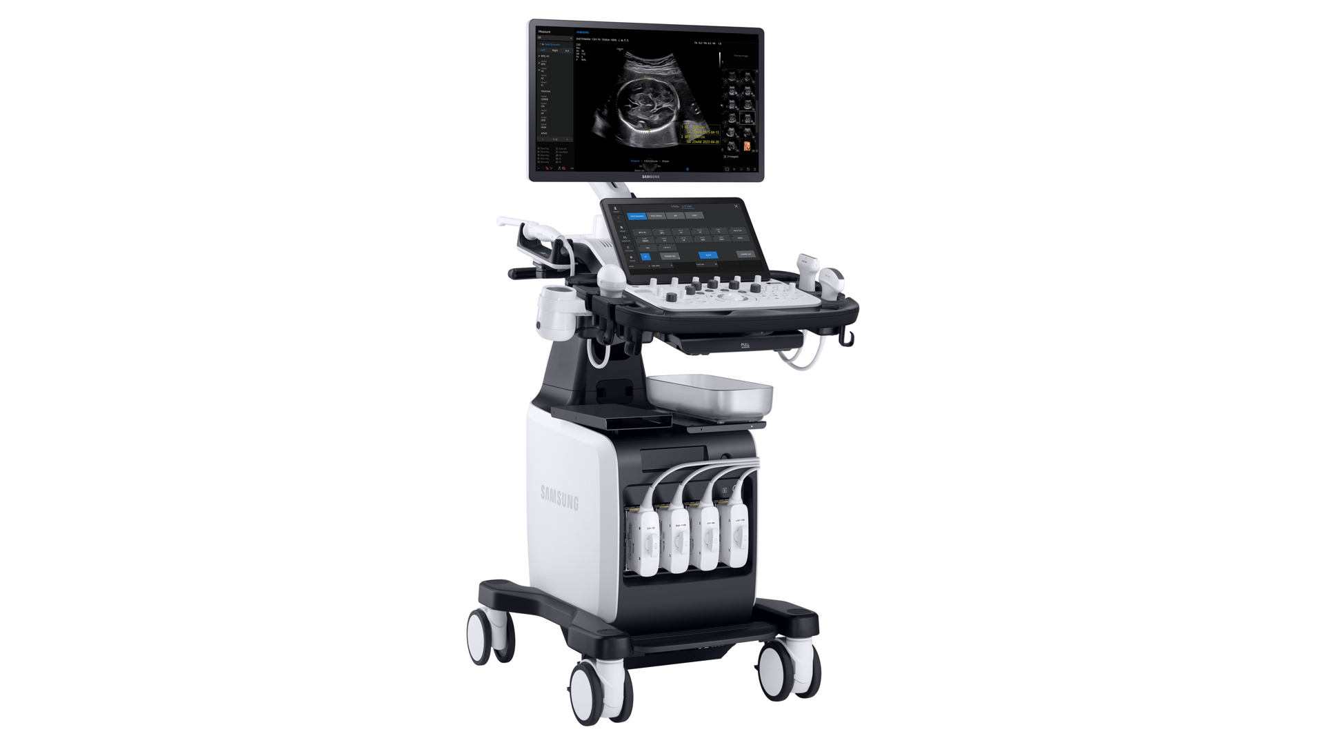 근골격계 초음파