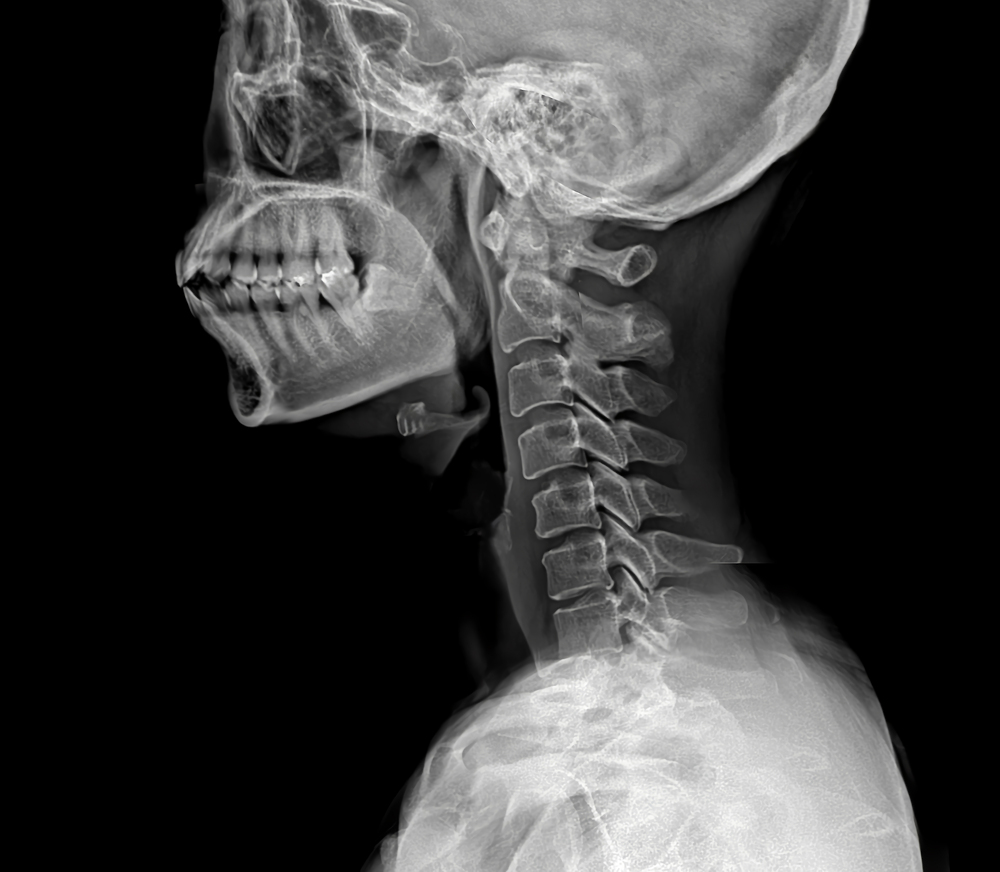 영상유도 신경치료