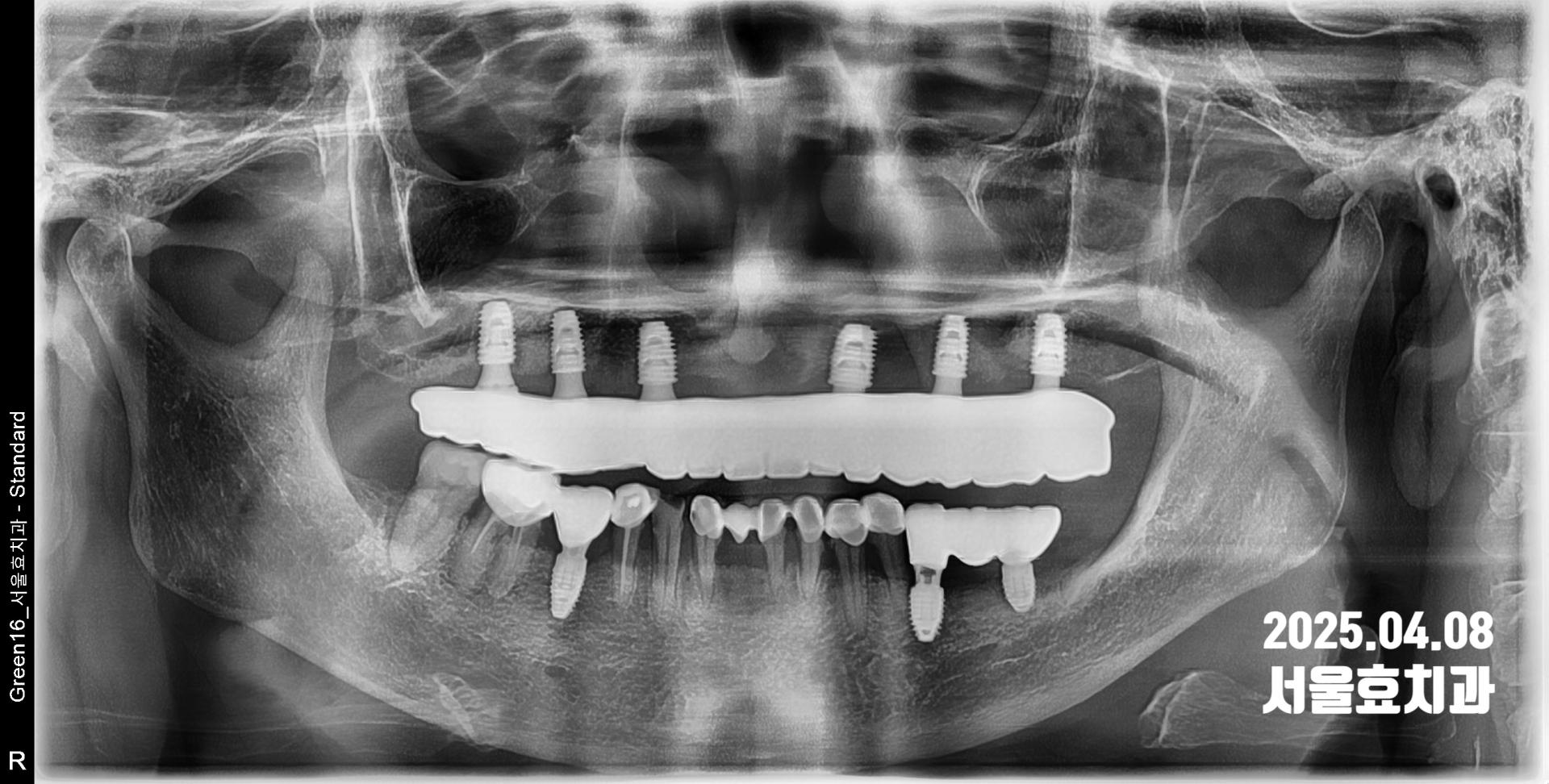 33f55eb84e768.jpg