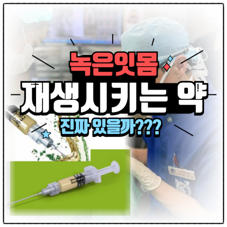 b9ac2c331f906.png