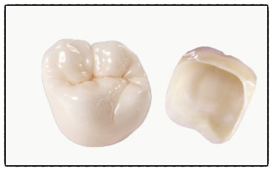 de6e4ae15d55d.jpg