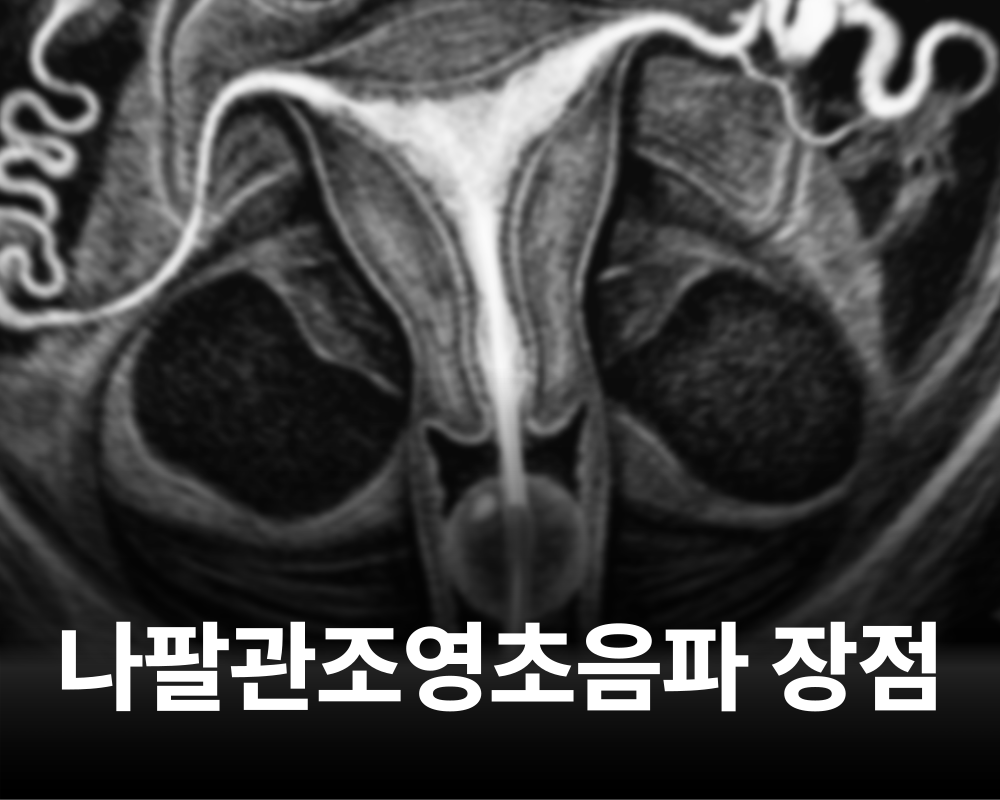 91953747705a6.png