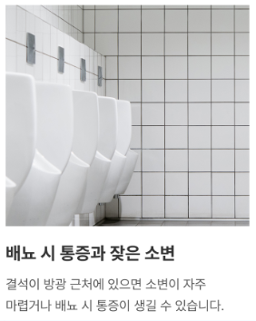 요로결석 배뇨장애 잔뇨감 빈뇨