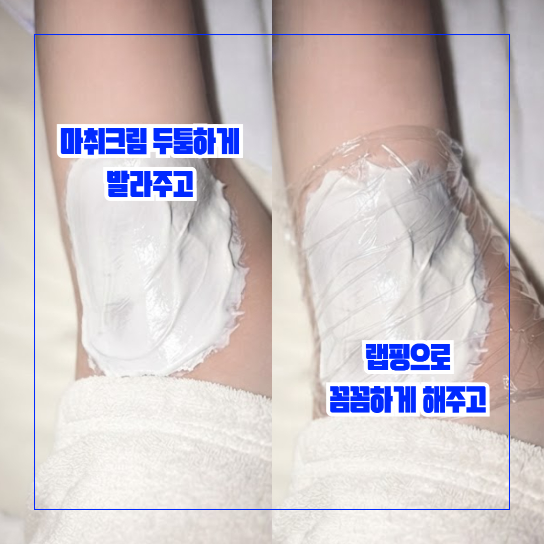 2a15cae1aa639.jpg