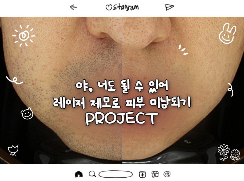 분당 미금 피부과 남자 제모 후기 이미지