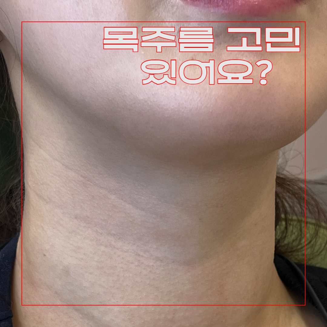 6be9a2a877086.jpg