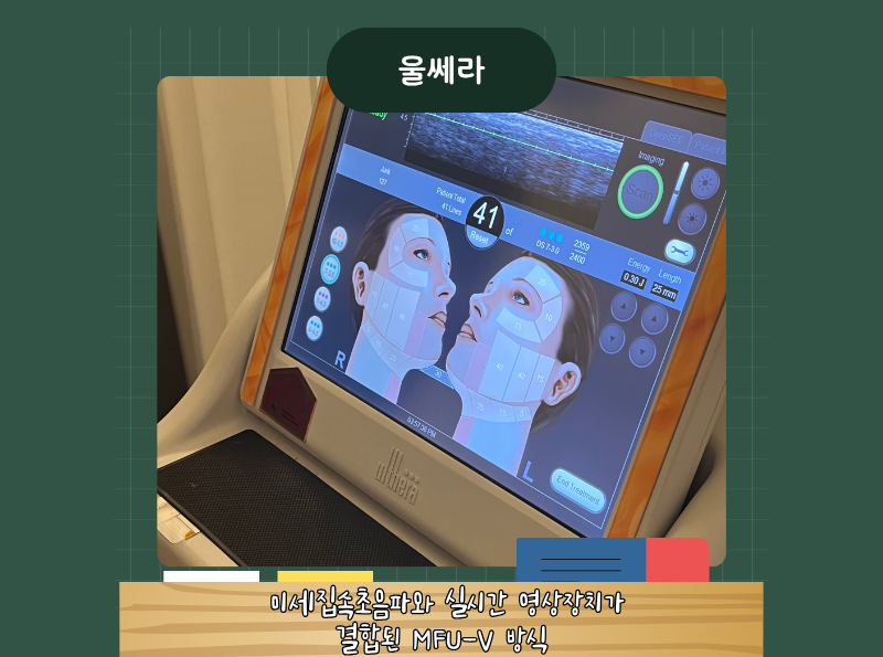 80bafe334d362.png