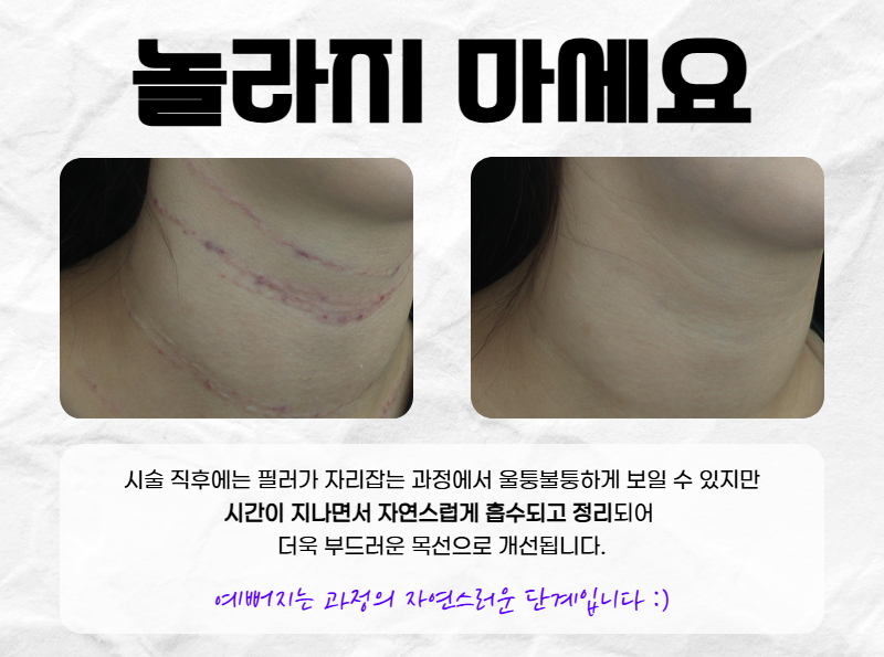 96028cdb75b00.png