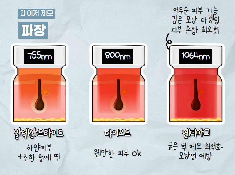 남성 수염 레이저 제모 시술 중 장면