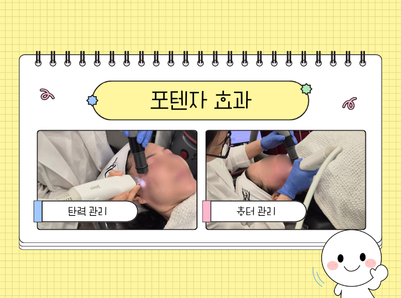 d78d204276752.png