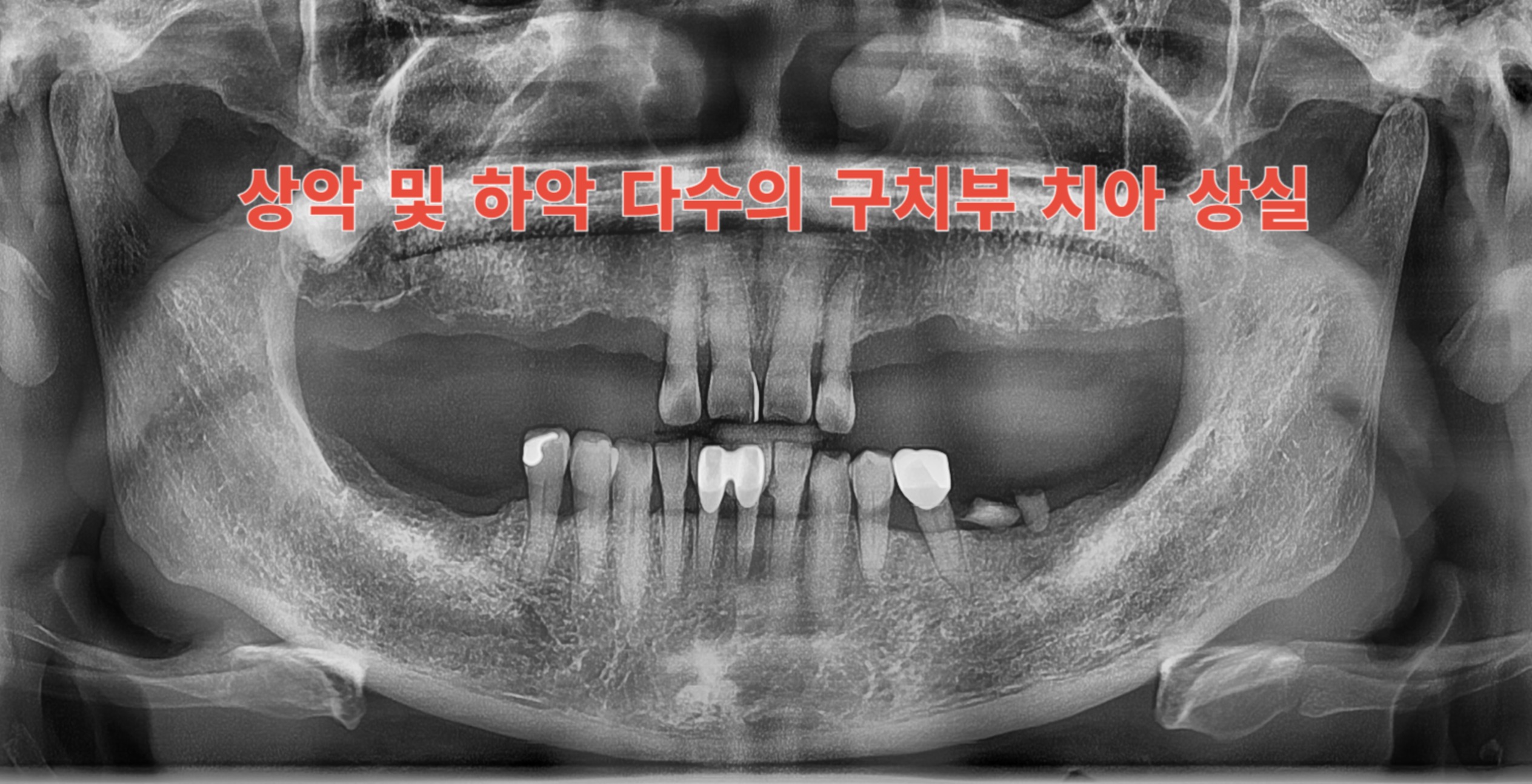[치료 전] 치료 전