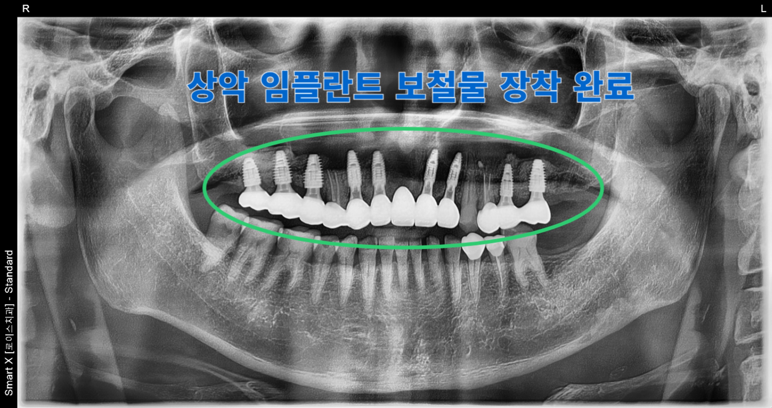 치료 후 상태