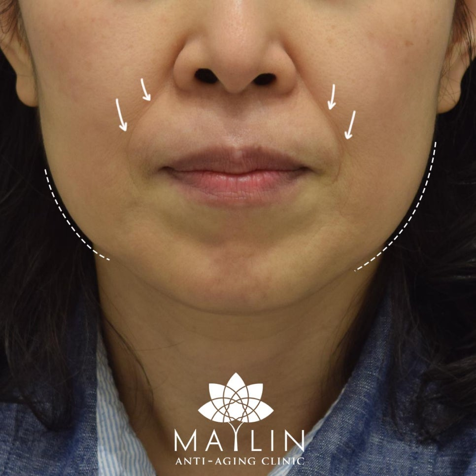 하…. 이 귀걸이 제주도 온천 갔다가 탈의실에 실수로 두고 나왔는데 누가 가져간 것 같아요……… 당연히 제대로 못 챙긴 제 잘못이지만  가슴이 찢어지네요 😇, image size:966x966