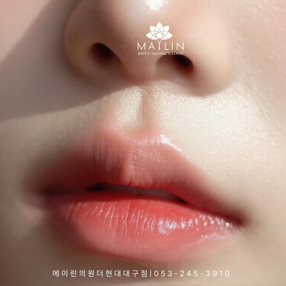 대구입술필러 멍과 붓기는 얼마나? : 메이린의원 닥터노트 | 대구 중구 동성로 반월당 성형외과 피부과