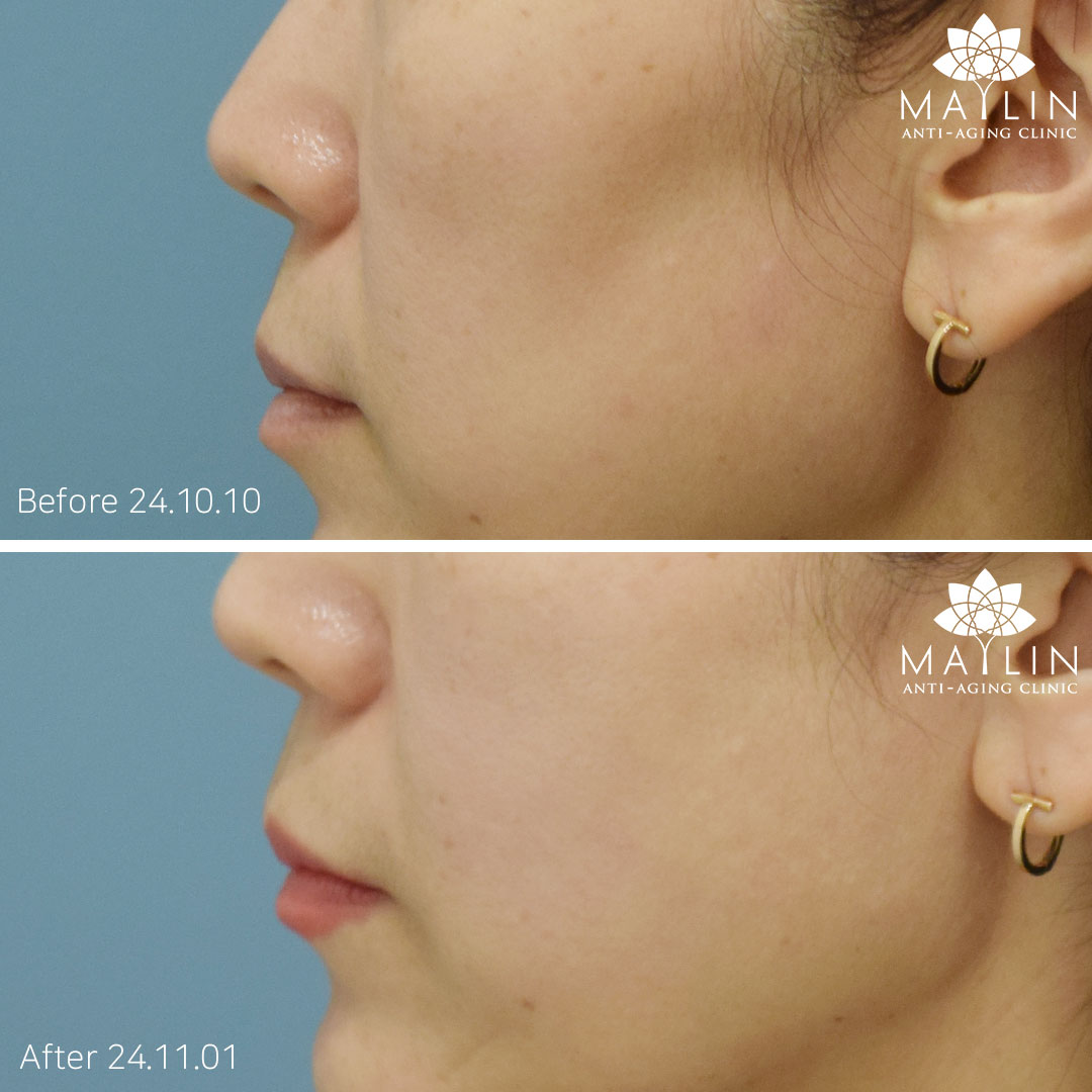 iOS 및 Android용 코 피어싱 앱, image size:1080x1080