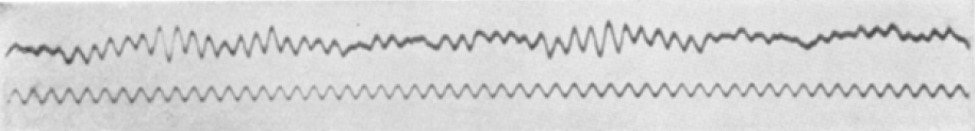 05ec277c1f98d.png