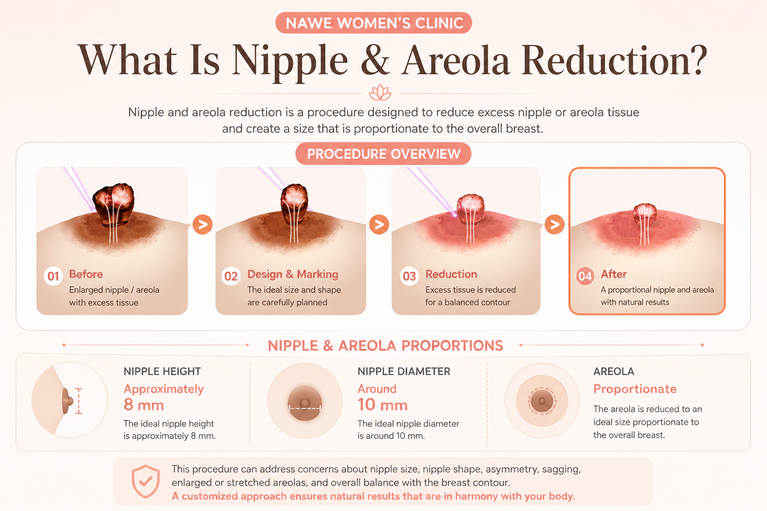 What is nipple and areola reduction?