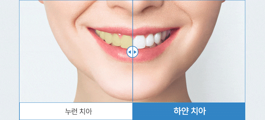 노도르 미백치약