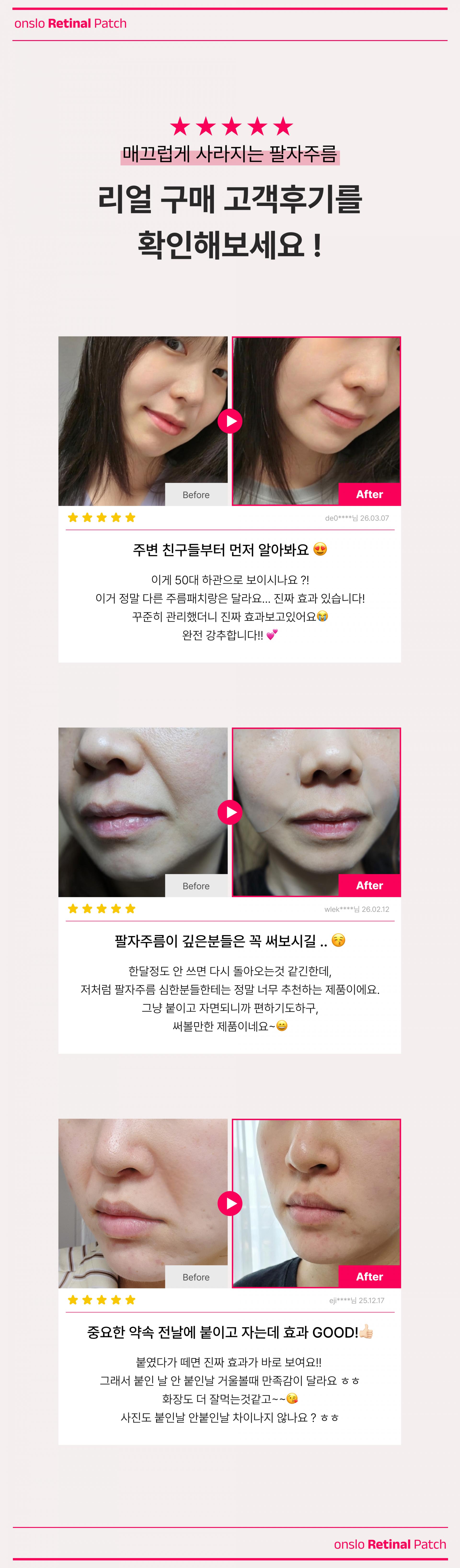 온슬로 레티놀 팔자주름패치_,0.1g*5, 40매