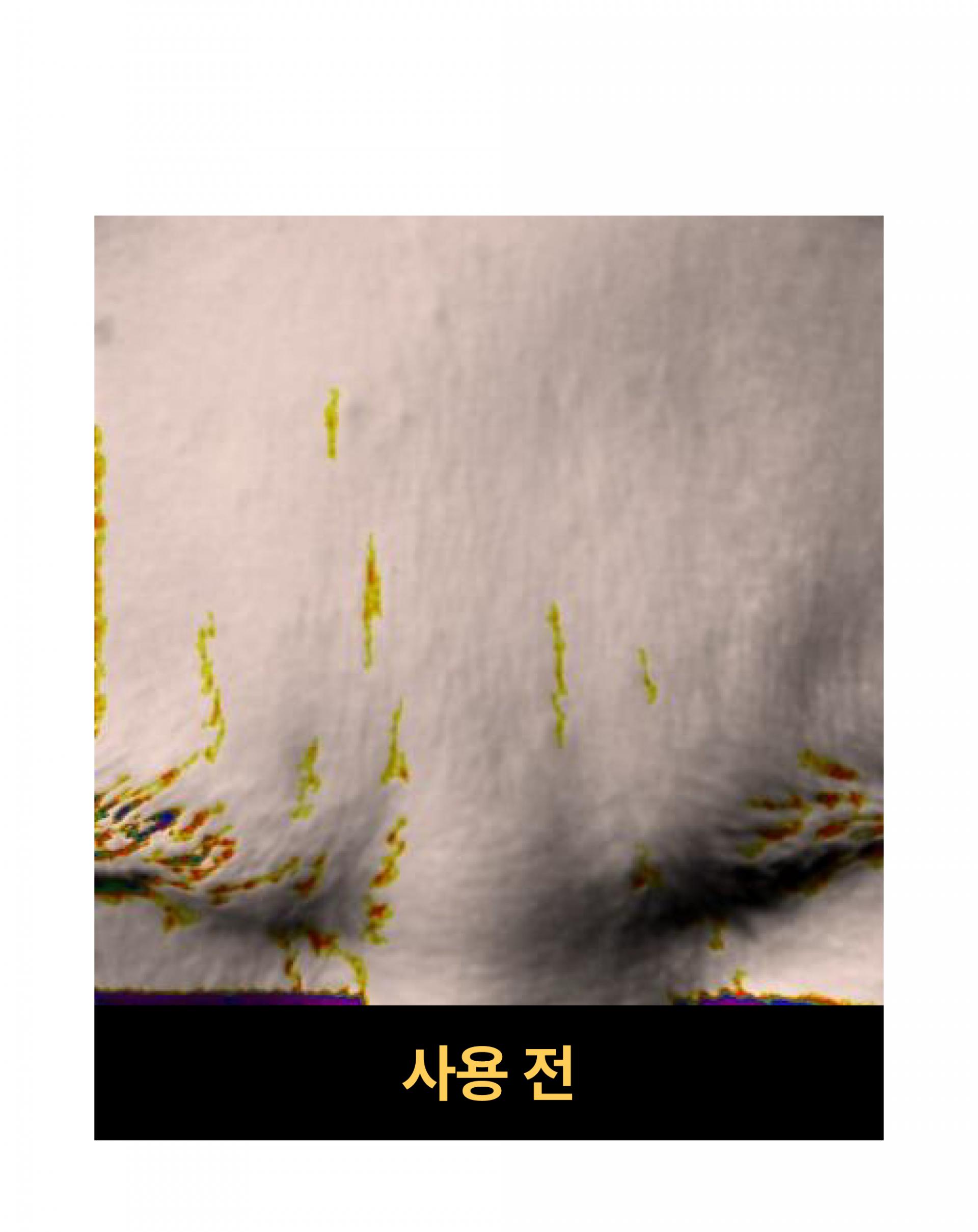 온슬로 레티날 미간주름패치_0.28g*5, 45매