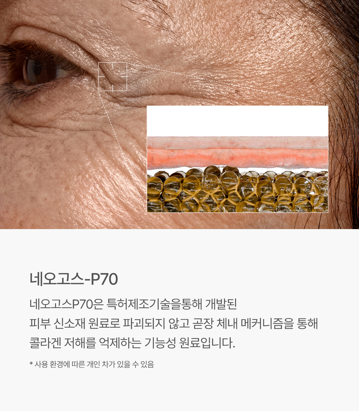 뮤르디 파이테론 네오고스 부스터