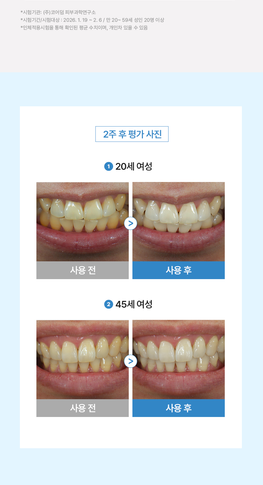 노도르 미백치약
