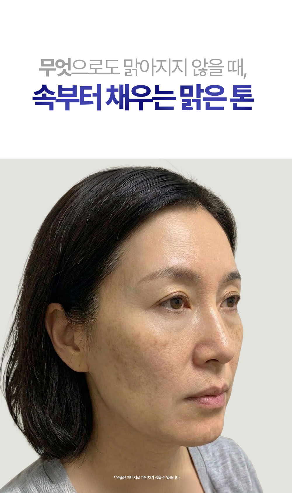 뮤르디 트라닉사 클리어 포뮬러