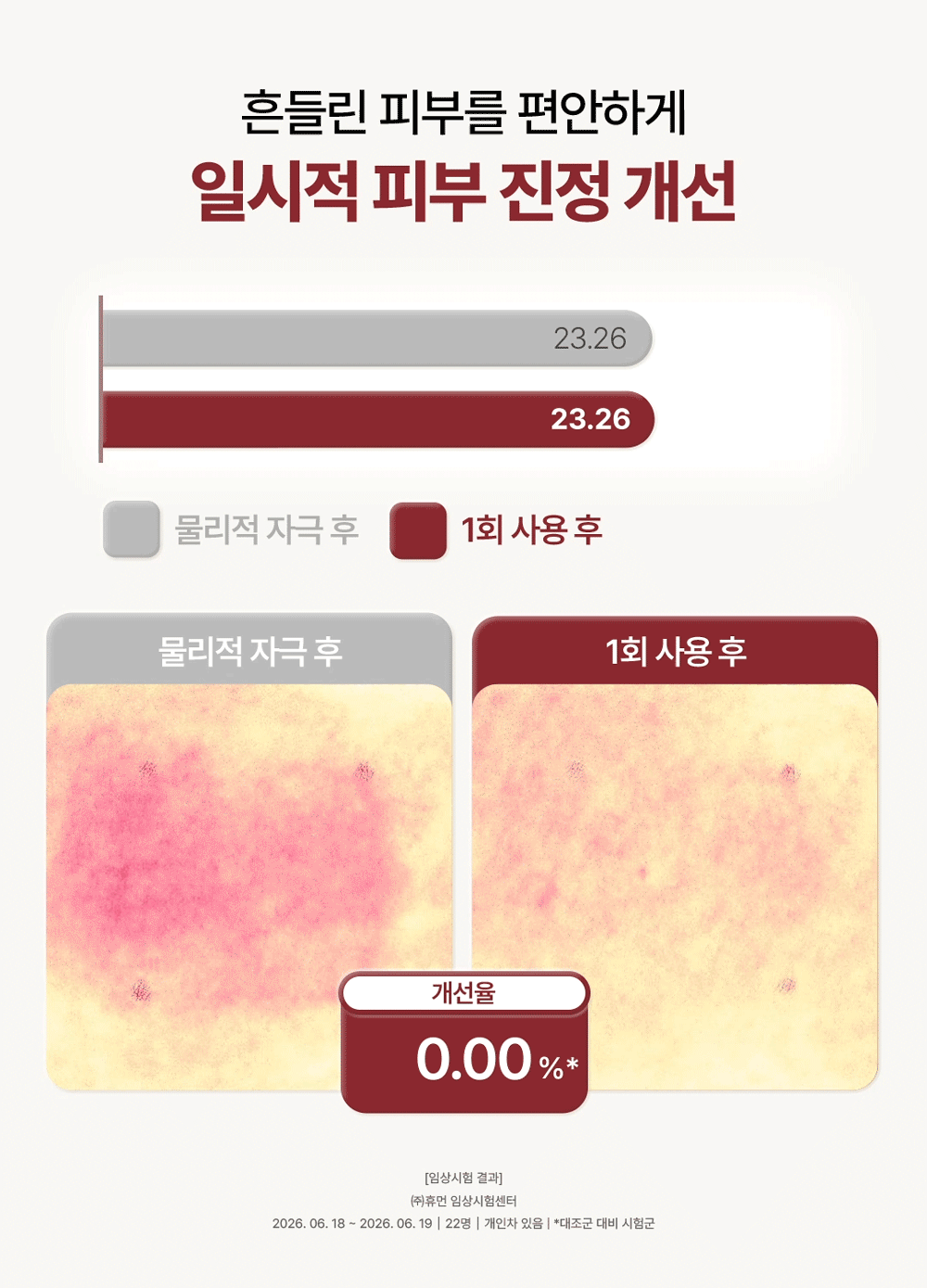 피코덤 NAD+ 리포좀 앰플